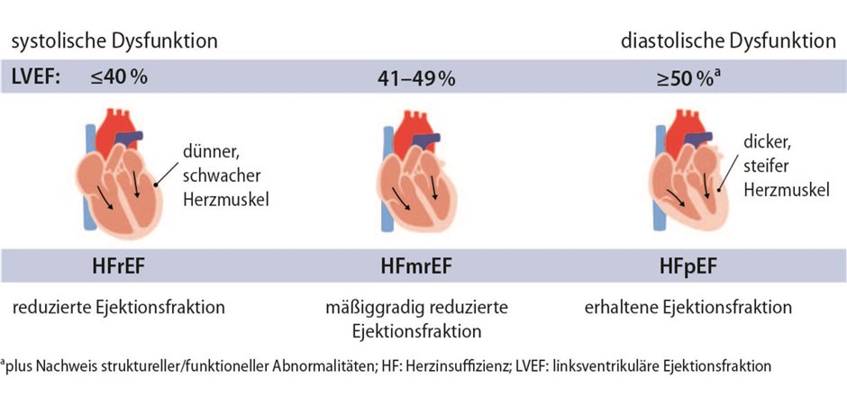 Herzinsuffizienz Blutdruck Hoch Oder Niedrig