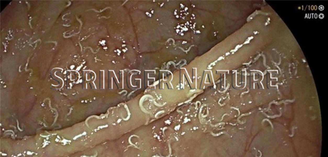 Wenn bei Bauchschmerzen der Wurm drin ist