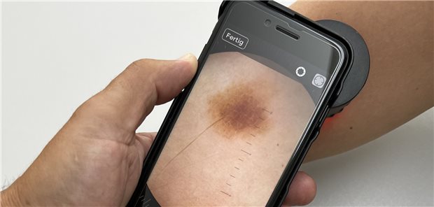 Abbildung einer digitalen Auflichtmikroskopie.