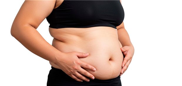 Auch bei Normalgewicht: Abdominale Adipositas erhöht kardiometabolisches Risiko Abdominale Adipositas fördert entzündliche Zytokine und Hormone und führt zu Insulinresistenz, Dyslipidämie, Bluthochdruck und gestörter Glukoseregulation.