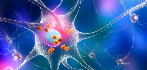 Ablagerungen von Lewy-Körperchen (rot) in einem Neuron: Diese sind typisch für die Degeneration der Zellen bei Morbus Parkinson.
