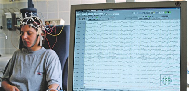 Ableitung eines Elektroenzephalogramms bei Verdacht auf eine fokale Epilepsie.
