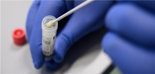 Laborärzte warnen vor Schnelltests auf Coronavirus Abstrich auf eine Infektion mit SARS-CoV-2. Wie sicher sind hier Schnelltests?