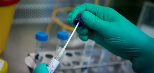 Laborverband ALM sieht Pooling-Tests kritisch Abstrich eines SARS-CoV-2-Verdachtsfalles: Die Testkapazitäten in Laboren werden aktuell bei weitem nicht ausgeschöpft.