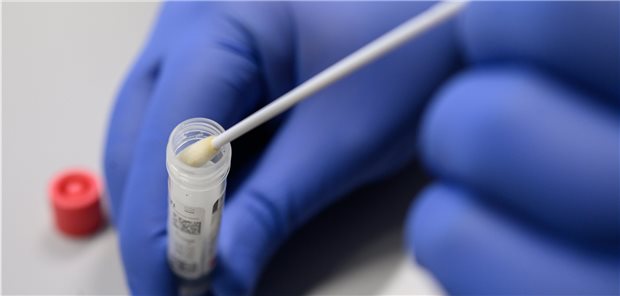 Bayern kündigt Corona-Tests für jedermann an Abstrich für Corona-Test: Bayern will die Möglichkeiten zu testen auch für Menschen ohne Symptome noch stärker erweitern, als es die Testverordnung vorsieht.