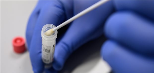 Hausärzte fordern Umdenken bei Testungen auf SARS-CoV-2 Abstrich für einen Test auf das Virus SARS-CoV-2.: Der Hausarztverband findet, dass zu häufig getestet wird.