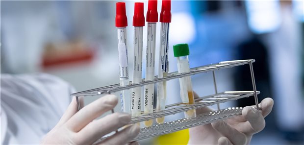 Laborärzte gegen Antigentests bei Großveranstaltungen Abstriche werden am Institut für Virologie der technischen Universität München (TUM) für die weitere Analyse vorbereitet. In Zukunft könnten in den Labors zusätzlich zu PCR- und Antikörpertests auch vermehrt Antigentests analysiert werden, um SARS-CoV-2 zu diagnostizieren. (Archivbild)