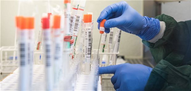 Abstrichröhrchen aller Orten: Die Labore kommen mit den PCR-Ressourcen über dem Limit.