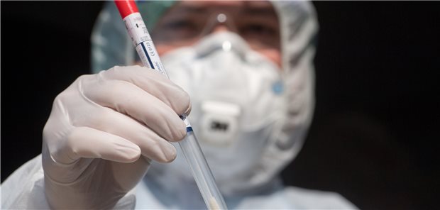 Industrie produziert SARS-Tests auf Hochtouren - reicht das? Abstrichstäbchen für den Test auf SARS-CoV2. Ab wann werden die Laborkapazitäten mit zu vielen Tests überfordert?