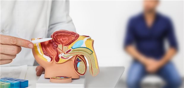 Abwarten, operieren oder bestrahlen? Je nachdem gibt es für GKV-Patienten bald einen Anspruch, die zweite Meinung eines Arztes einzuholen.