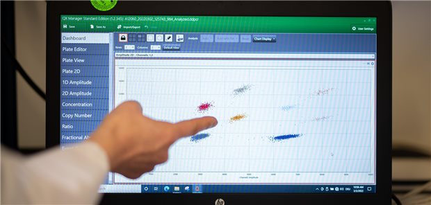 Abwasser-Monitoring auf SARS-CoV-2 in Hamburg: Eine gute Technik, solange sie in den richtigen Händen bleibt.