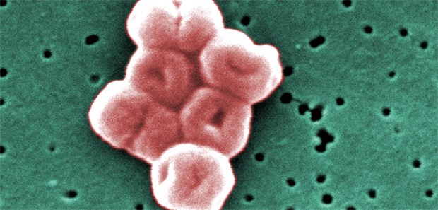 Problemkeim fordert Klinikpersonal heraus Acinetobacter baumannii: Der Keim beunruhigt Ärzte am Universitätsklinikum Kiel.