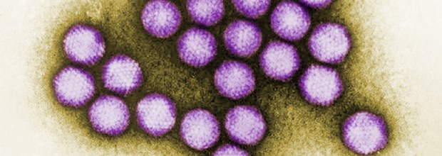 Adenovirus legt Augenklinik lahm Adenoviren in Farbe: In Bottrop haben sie für gehäufte Fälle von Bindehautentzündungen gesorgt.