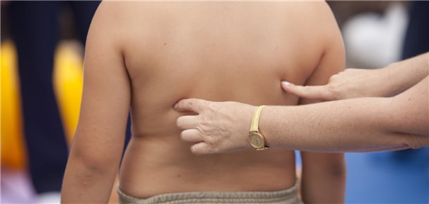 Adipositas ist ein Forschungsschwerpunkt an der Medizinischen Fakultät der Universität Leipzig.
