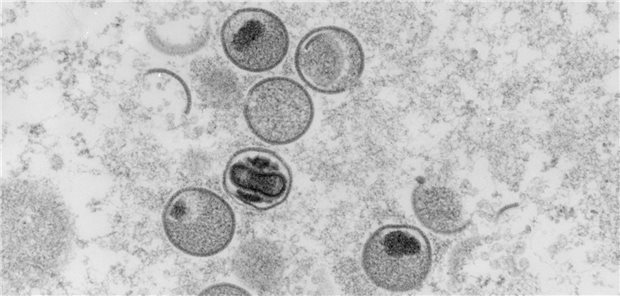 Wie sollen Affenpocken heißen? Community macht skurrile Vorschläge – WHO benennt Subtypen um MPXV, Monkeypox virus. Transmission electron microscopy, ultrathin section. Bar = 200 nm. Freya Kaulbars (2004)