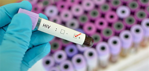Aids-Schleife in Händen: Für das Erkennen der HIV-Infektion und die Therapie benötigt jeder Arzt ein wenig Handwerkszeug.