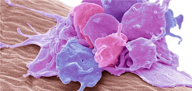 Thrombozyten machen es Tumorzellen leicht Aktivierte Thrombozyten unter dem Elektronenmikroskop.