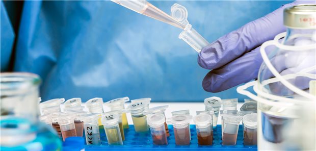 Aktuell in China zirkulierende SARS-CoV-2-Viren: Bislang noch keine unbekannte Variante gemeldet.
