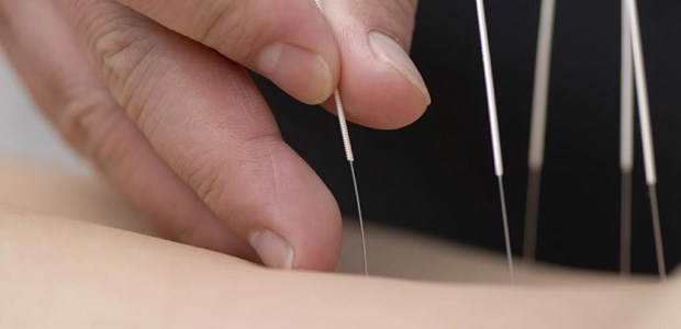 Von Schamanen lernen Akupunktur: Hier tobt noch ein Expertenstreit, ob es signifikante Unterschiede zwischen "richtigem" Nadeln und Scheinakupunktur gibt.