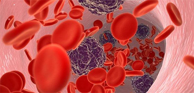Antikörper sollen Leukämie-Krebszellen eliminieren Akute myeloische Leukämie (AML): Erythrozyten und Krebszellen in einer Vene.