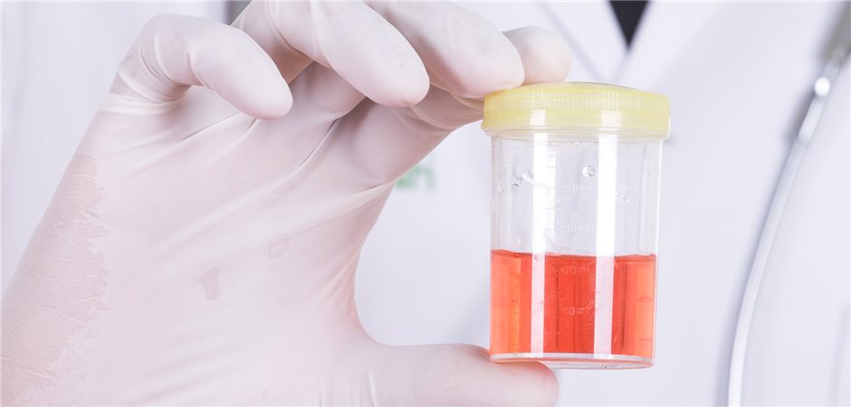 Blut Im Urin Nach Sport www.aerztezeitung.de