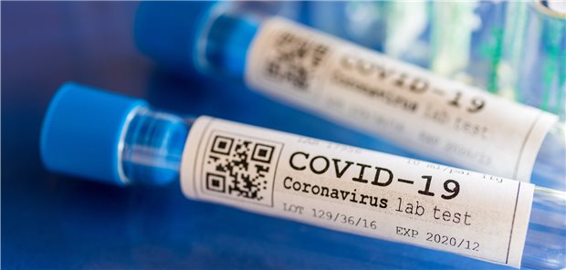 Vertragsärzte und Kassen wollen Corona-Tests auf Kosten der Steuerzahler Alle sind sich einig, dass mehr auf COVID-19 getestet werden soll. Strittig ist nur, wer für die Kosten aufkommen soll.