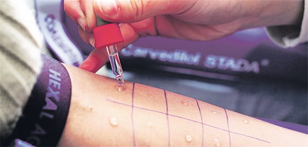 Allergologie-Zusatzbezeichnung lohnt sich nicht Allergie-Test: Es gibt immer weniger Ärzte mit der Zusatzbezeichnung Allergologie.
