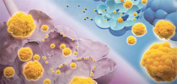 Alpha1-Antitrypsin (blau) bindet irreversibel an die Neutrophilen-Elastase (gelb). Die schädigende Wirkung des Enzyms auf das Lungengewebe (links) kann dadurch erheblich verringert werden, die Alveolen werden geschützt (rechts).