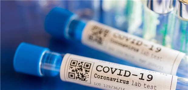 WHO testet vier COVID-19-Medikamente Als aussichtsreichster Kandidat für die COVID-19-Therapie gilt derzeit das Ebola-Medikament Remdesivir.