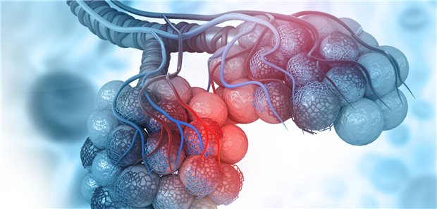 Alveolen: Bei etwa 0,5 bis 1,5 Millionen Menschen jährlich verkleben die Alveolen infolge einer pulmonalen Alveolarproteinose.
