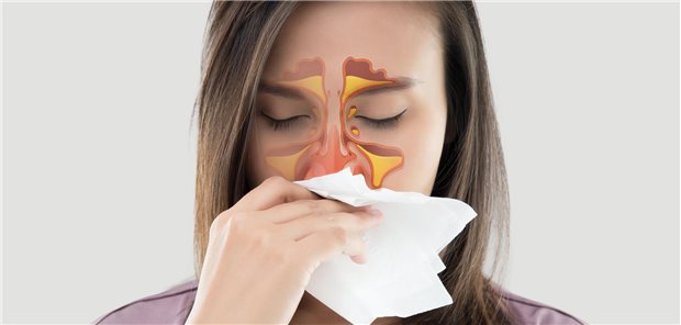 Am stärksten war die Assoziation einer Rheumaerkrankung zu Nebenhöhlenentzündungen. Das Risiko, Rheuma zu bekommen, war bei Personen, die nie geraucht hatten, und solchen mit sieben und mehr Sinusitis-Codierungen mit einer Wahrscheinlichkeit von 1,7 am höchsten.