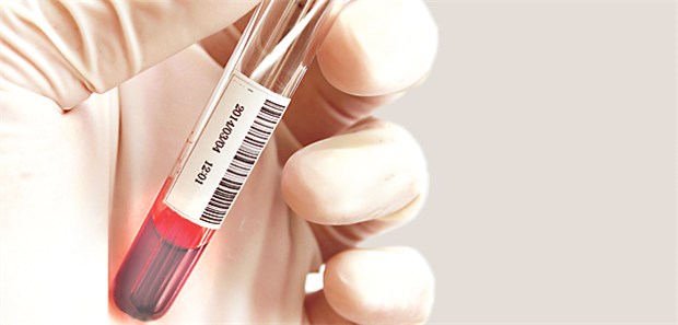 An Demenz-Bluttests wird seit Jahrzehnten geforscht.