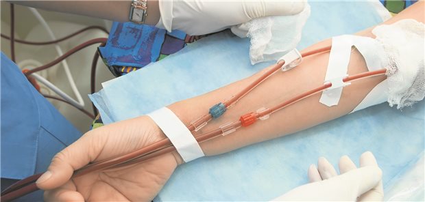 An der Dialyse: Eine ganze Reihe von Faktoren erschweren die Blutdruckkontrolle.
