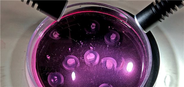 An in vitro- und ex vivo-Modellen wird jetzt eine neues Drug Delivery System auf Effektivität validiert. Ziel ist die Verbesserung der Therapieoptionen bei Glioblastom.