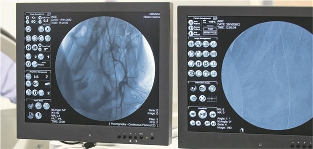 Angiografie: Einzig akzeptierte Form der Prophylaxe von Nierenschädigungen infolge Kontrastmittelgabe ist derzeit die Hydratation durch Gabe von isotonischer Natriumchloridlösung.