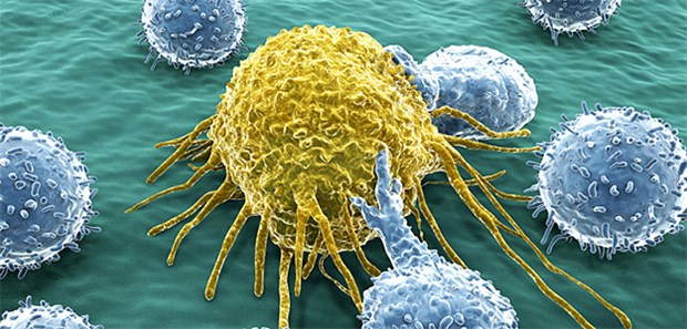 Car-T-Zelltherapien kontrolliert einführen! Angriff auf eine Krebszelle: Bei aggressiven Formen von Blutkrebs wird hierzu auf die Car-T-Zelltherapie gesetzt.