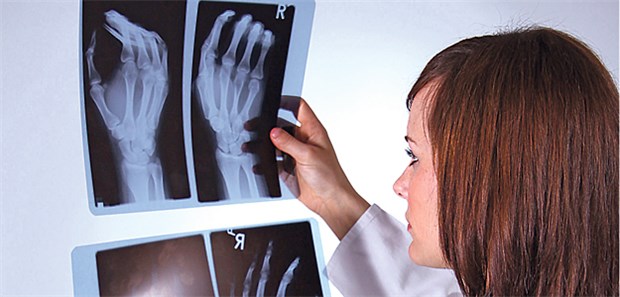 Anhand radiologischer Befunde lässt sich das Stadium einer Rheumatoiden Arthritis beurteilen. Zwischen den Knochenschäden und einem Suszeptibilitätsmarker für die Autoimmunerkrankung besteht ein Zusammenhang,