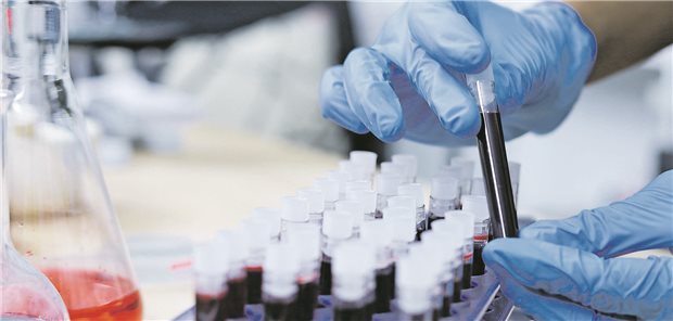 Anstatt sich nur auf die Cholesterinwerte zu fokussieren, könnte ein genauer Blick auf den hs-CRP-Wert zusätzlich helfen, das kardiovaskuläre Risiko des Patienten zu bestimmen.