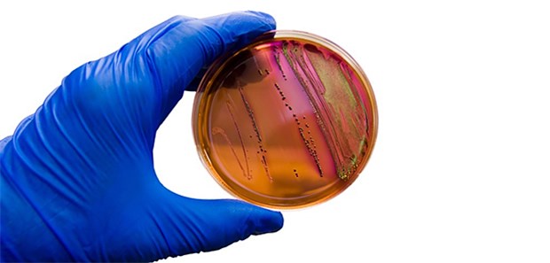Auf der Suche nach dem Fünf-Minuten-Test Antibiotika-Resistenzen: Ein zunehmendes Problem.