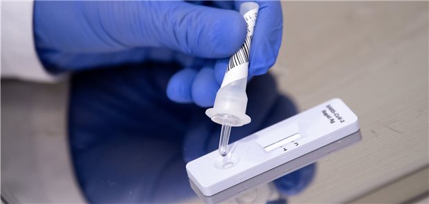 EU-Kommission setzt im Kampf gegen Corona auf Antigen-Schnelltests Antigen-Schnelltest zum COVID-19-Antikörper-Nachweis sieht die EU-Kommission als entscheidendes Werkzeug im Kampf gegen das Coronavirus.