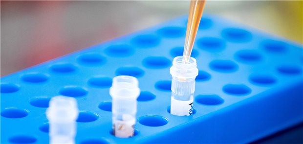 Antikörper-Suche im Labor.