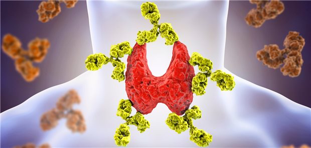 Antikörper haben die Schilddrüse erreicht. Hat das eine Konsequenz für die Therapie?