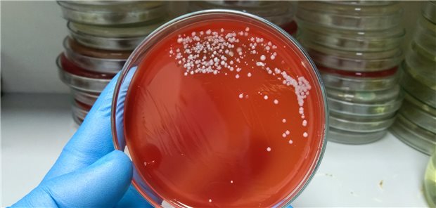 Anzucht von Staphylococcus aureus auf Blutagar.