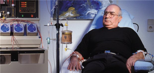 Aphärese bei Long-COVID? Die Deutsche Gesellschaft für Nephrologie mahnt, Registerauswertungen und erste Studienergebnisse zur Wirksamkeit abzuwarten.