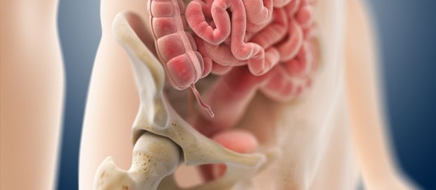 Bildgebung erspart Op Appendix vermiformis: Ob er entzündet ist, zeigen Sono und CT.