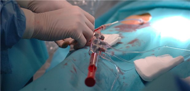 Herz-Kreislauf-Erkrankungen bleiben Todesursache Nummer eins Arbeit im Katheterlabor. Pro Jahr werden mehr als 1,7 Millionen Menschen wegen Herzkrankheiten vollstationär in Kliniken versorgt, berichtet die Herzstiftung.