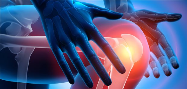 Arthrose-Patienten nutzen Physiotherapie zu selten Arthrose im Kniegelenk: Bewegungsübungen können bei Patienten mit einer Knie- oder Hüftarthrose nicht nur Schmerzen reduzieren, sondern auch dazu beitragen, die Beweglichkeit der Gelenke zu erhalten.