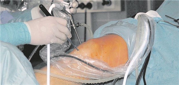 Arthroskopie: Auf den Fortschritt der Gelenkschäden hatte eine Op wenig Einfluss.