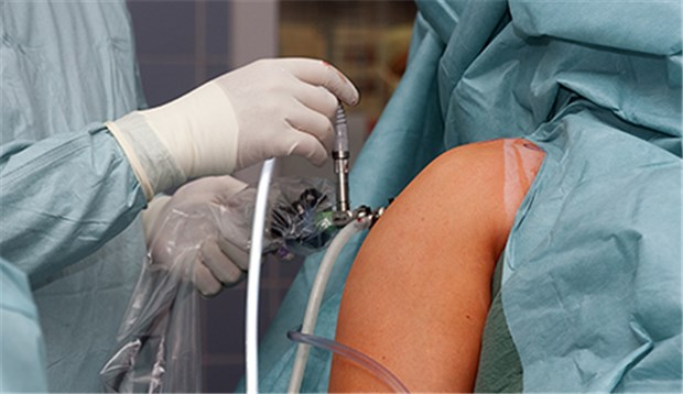 An der Schulter wird gerne und viel arthroskopiert Arthroskopie an der Schulter: mittlerweile Quasi-Standard bei vielen Eingriffen.