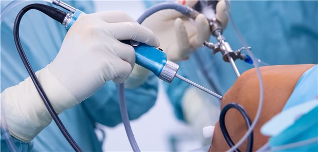 KBV mahnt mehr Tempo beim ambulanten Operieren an Arthroskopie in der Orthopädischen Chirurgie München (OCM). Arthroskopien, Karataraktoperationen und Biopsien sind Eingriffe, die häufig ambulant vorgenommen werden.